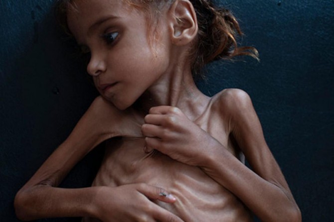 Emel Huseyîna 7 salî ji birçîbûnê jiyana xwe ji dest da