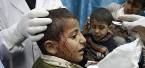 İsrail saldırısında 29 çocuk yaralandı