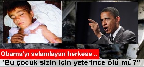 “Bu çocuk sizin için yeterince ölü mü?”