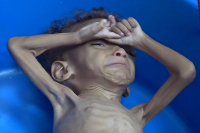 Navê cihê ku; lê zilm, qetlîam û hovîtî tên kirin û zarok ji birçînan lê dimirin Yemen e