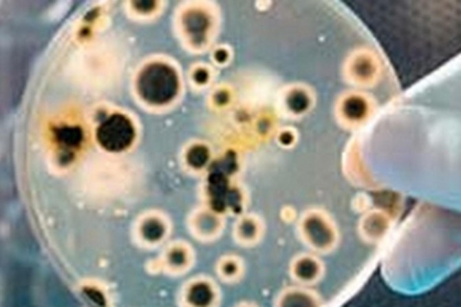 Geçen yıl 6 bin 547 kişi bruselloz hastalığına yakalandı