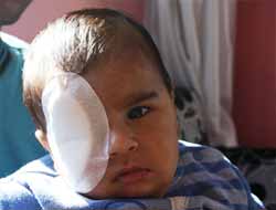 3 Aylık Bebek Gözünden Ameliyat Edildi