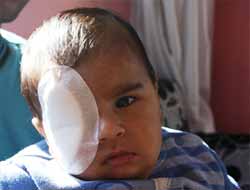 3 Aylık Bebek Gözünden Ameliyat Edildi (Video)