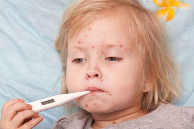 Dünya Sağlık Örgütünden kızamık uyarısı