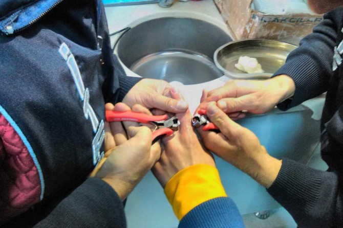 Bitlis’te parmağına yüzük sıkışan gencin imdadına itfaiye ekipleri yetişti