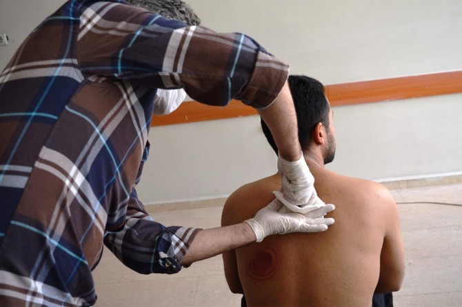 Şehir hastanesinde geleneksel tedavi yöntemleri