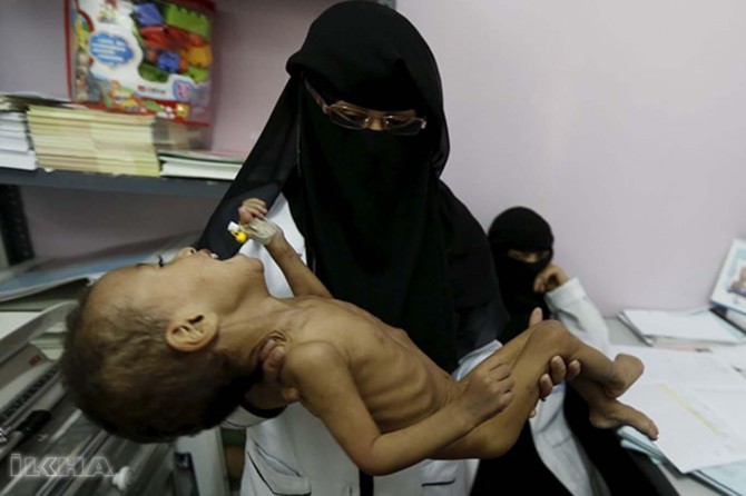 A child dies every 10 minutes in Yemen
