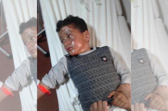 Ateşe verilen yalıtım malzemelerinde patlama: Bir yaralı