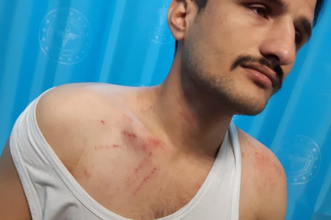 Güvenlik korucuları başkanına saldırı