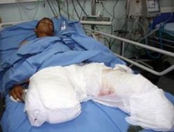 'Saldırılar 60 Filistinli'yi özürlü yaptı'