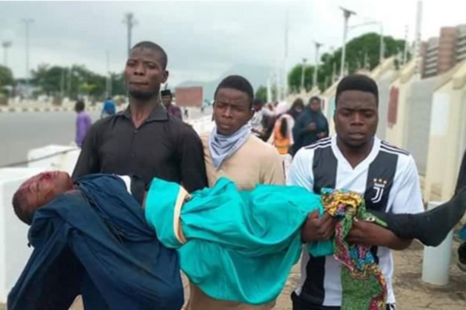 Polêsan êrîş birin li ser xwepêşana ku ji bo Şêx Zakzakî dihat tertîpkirin