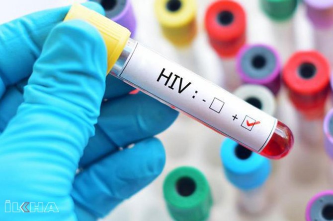 HIV positive kills 20,000 people in Russia