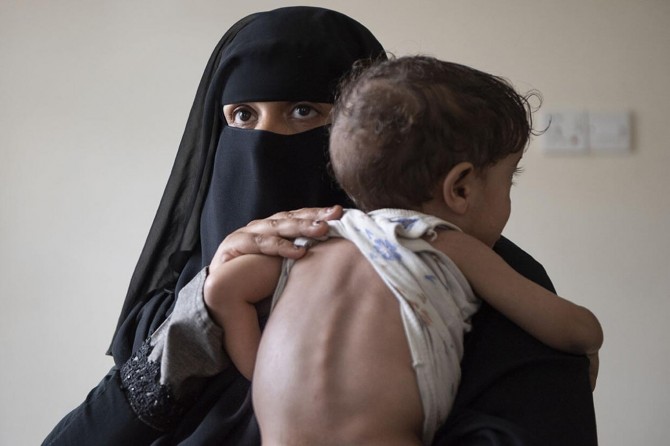 Rêxistina Tenduristîyê ya Cîhanê derbarê Yemenê de hişyarî da