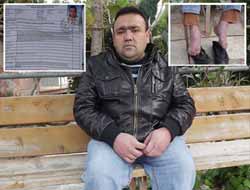 Özürlü Olduğu İçin İş Bulamıyor