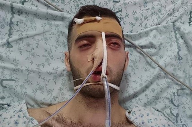 Siyonist terör çetesi, Filistinli esirlere sistematik işkence uyguluyor