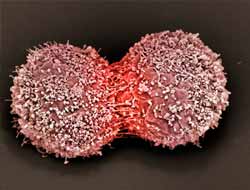 Ji Bo Qanserê Hêviyeke Nû