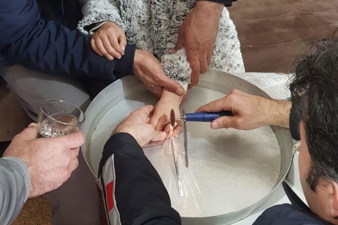 Çocuğun parmağına sıkışan cıvata somununu itfaiye ekipleri çıkardı