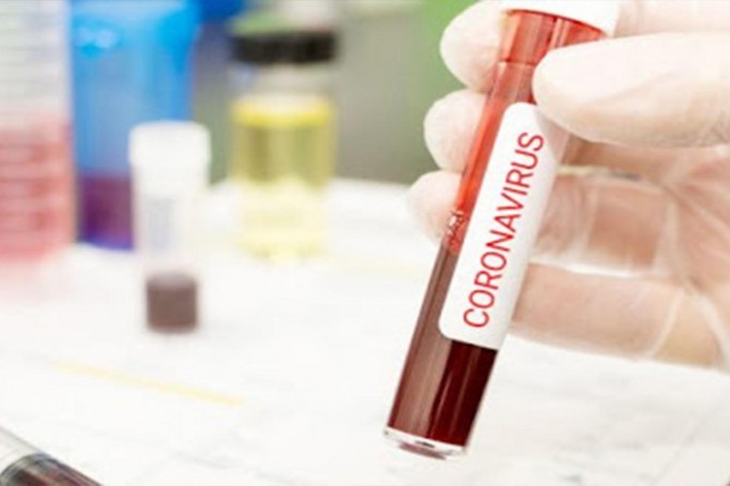 Li îtalyayê hejmara kesên ku ji ber coronavîrusê mirin derket 107an