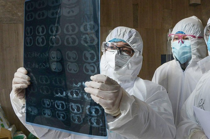 Covid-19’da nadir görülen belirtiler insanları yanıltıyor mu?