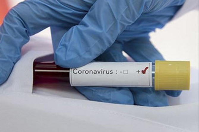 İtalya'da Coronavirus'ten ölenlerin sayısı 18 bin 849'a yükseldi