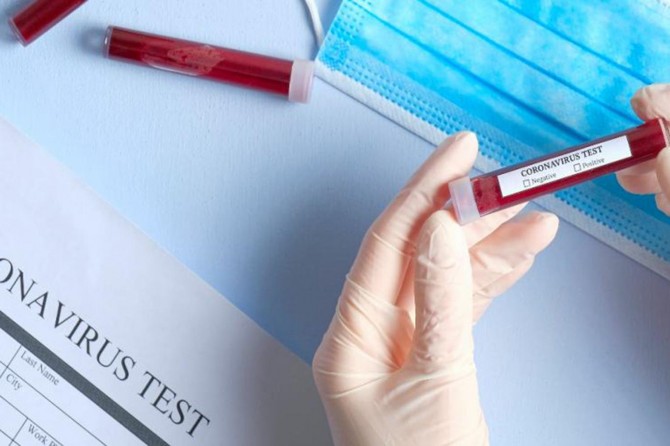 Hollanda'da Coronavirus'ten son 24 saatte 181 kişi öldü