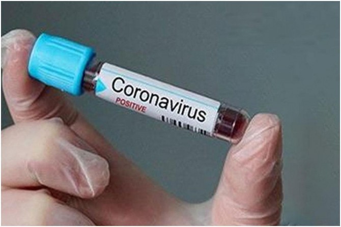 Yurt dışında Coronavirus nedeni ile ölen Türkiye vatandaşlarının sayısı 320 oldu