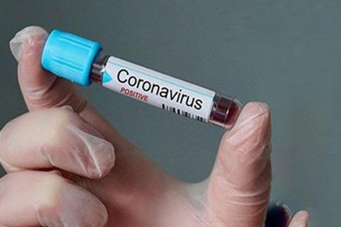 Fransa'da Coronavirus nedeni ile son 24 saatte 761 kişi daha öldü