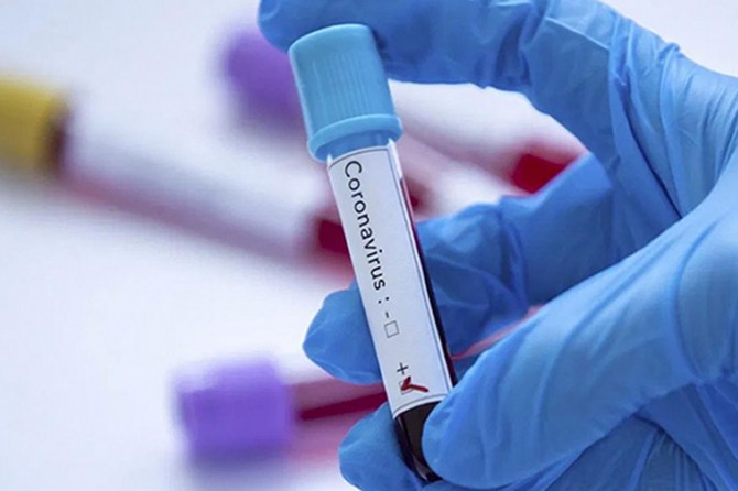 İran’da Coronavirus’ten iyileşenlerin sayısı 65 bine yaklaştı