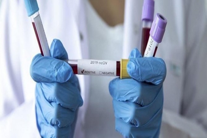 Irak’ta toplam Coronavirus vaka sayısı 1677’ye yükseldi