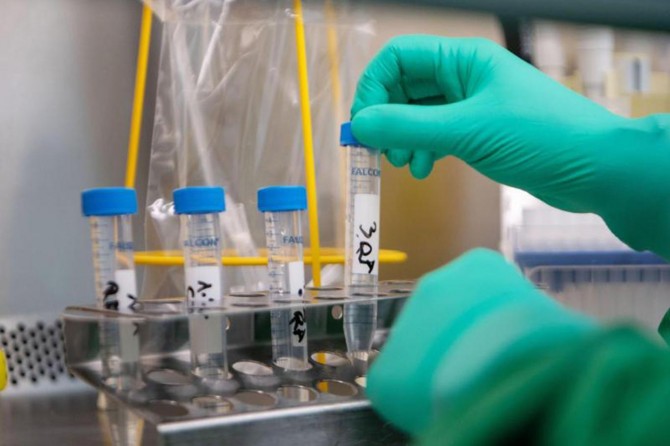 Iran’s daily death toll from coronavirus drops to 65