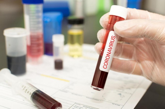 Fransa'da Coronavirus nedeniyle ölenlerin sayısı 26 bin 380'e yükseldi