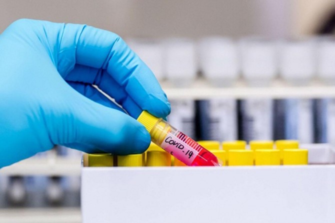 Suudi'de 2 bin 736 yeni Covid-19 tanısı kondu