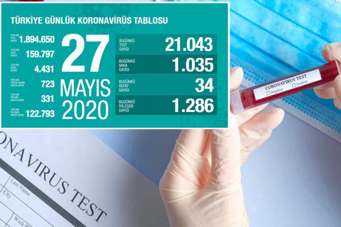 Türkiye'de Covid-19'dan 34 kişi daha hayatını kaybetti, bin 35 yeni tanı kondu