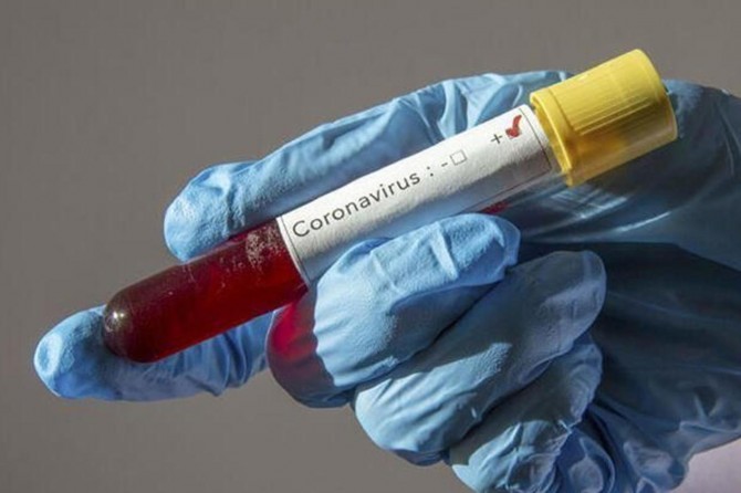 İspanya'da son iki günde Covid-19'dan hayatını kaybeden olmadı