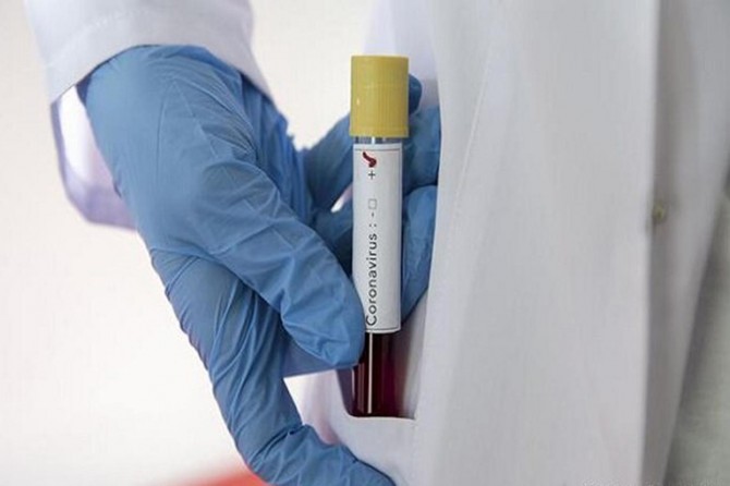 Azerbaycan'da Coronavirus vaka sayısı 6 bin 522'ye yükseldi