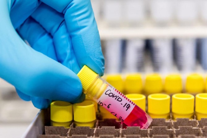 Yemen’s death toll from coronavirus rises to 111