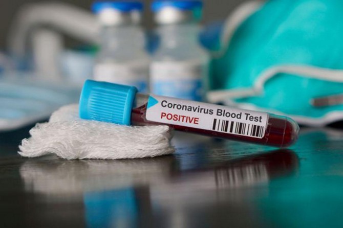 Li tevahîya cîhanê hejmara kesên ku ji ber Coronavîrusê mirin derket li ser 428 hezarî