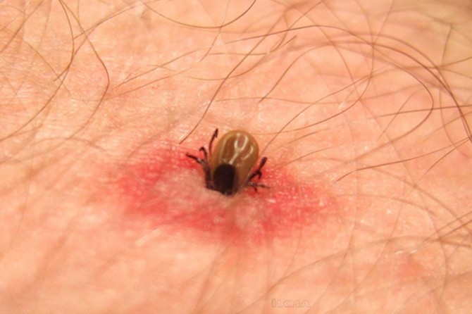 Kene kaynaklı ölümler ve vaka sayısı artıyor