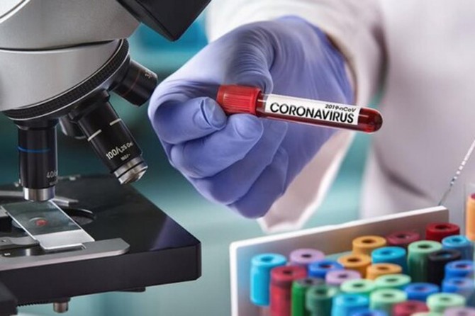 Global death toll from coronavirus rises to 466,871