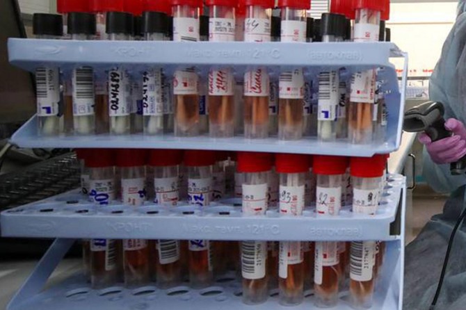 Palestine reports 207 new coronavirus cases in a single day