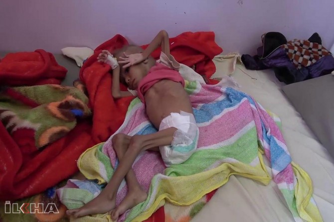 UNICEF: “Covid-19 salgını nedeniyle milyonlarca Yemenli çocuk açlıkla karşı karşıya”