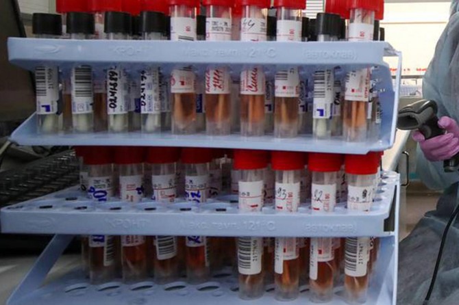 Endonezya, Bangladeş, Malezya ve Filipinler'de Covid-19'un son durumu