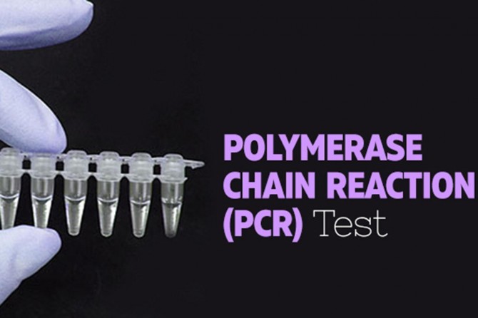 Yurtdışına çıkanlar ücretli Coronavirus testi yapabilecek