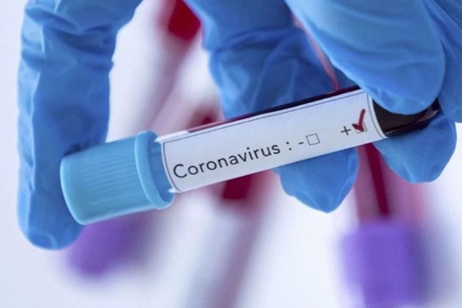 Suudi Arabistan’da Coronavirus vaka sayıları artıyor