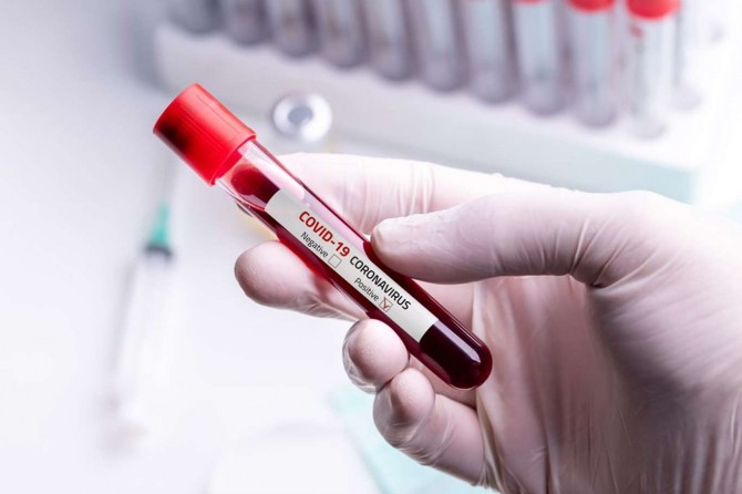 Coronavirus: Turkey reports 49 new deaths, 1,642 cases in the last 24 hours