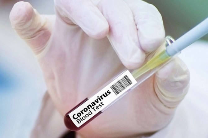 Turkey’s daily death toll from coronavirus rises to 53