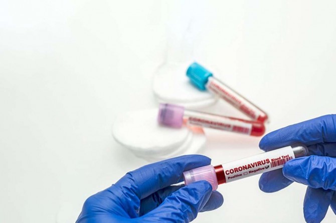 Fransa'da son 24 saatte yaklaşık 9 bin Coronavirus vakası görüldü