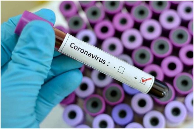United States reports 52,853 new coronavirus cases over the past 24 hours