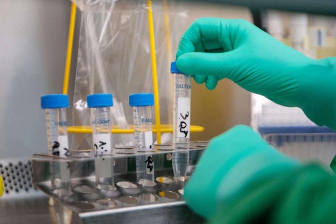 Coronavirus: Turkey reports 53 new deaths, 1,578 cases in the last 24 hours