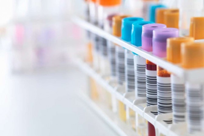 Turkey’s death toll from coronavirus reaches 6,837